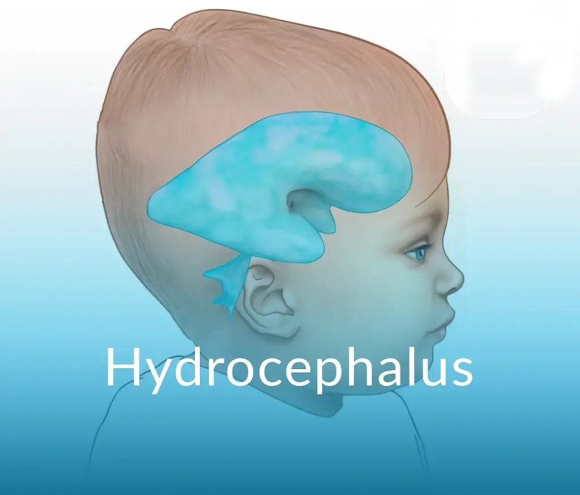 Healing Hands Neuro Physiotherapy Centre Lajpat Nagar-1, New Delhi , Dynamic Movement Intervention (DMI) Therapy in Delhi, Muscle Tone, Segmental Control, and Proper Alignment(MTF-Focused Therapy), Neurodevelopmental Therapy (NDT), Neurological Physiotherapy, Speech Therapy, Toe Walking in Delhi